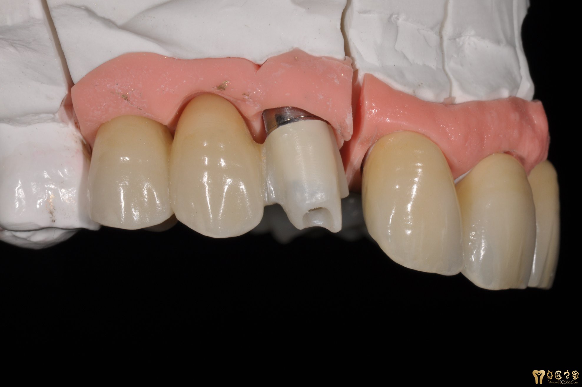 美学仿生案例-精华推荐-牙匠之家 - 中国牙匠之家