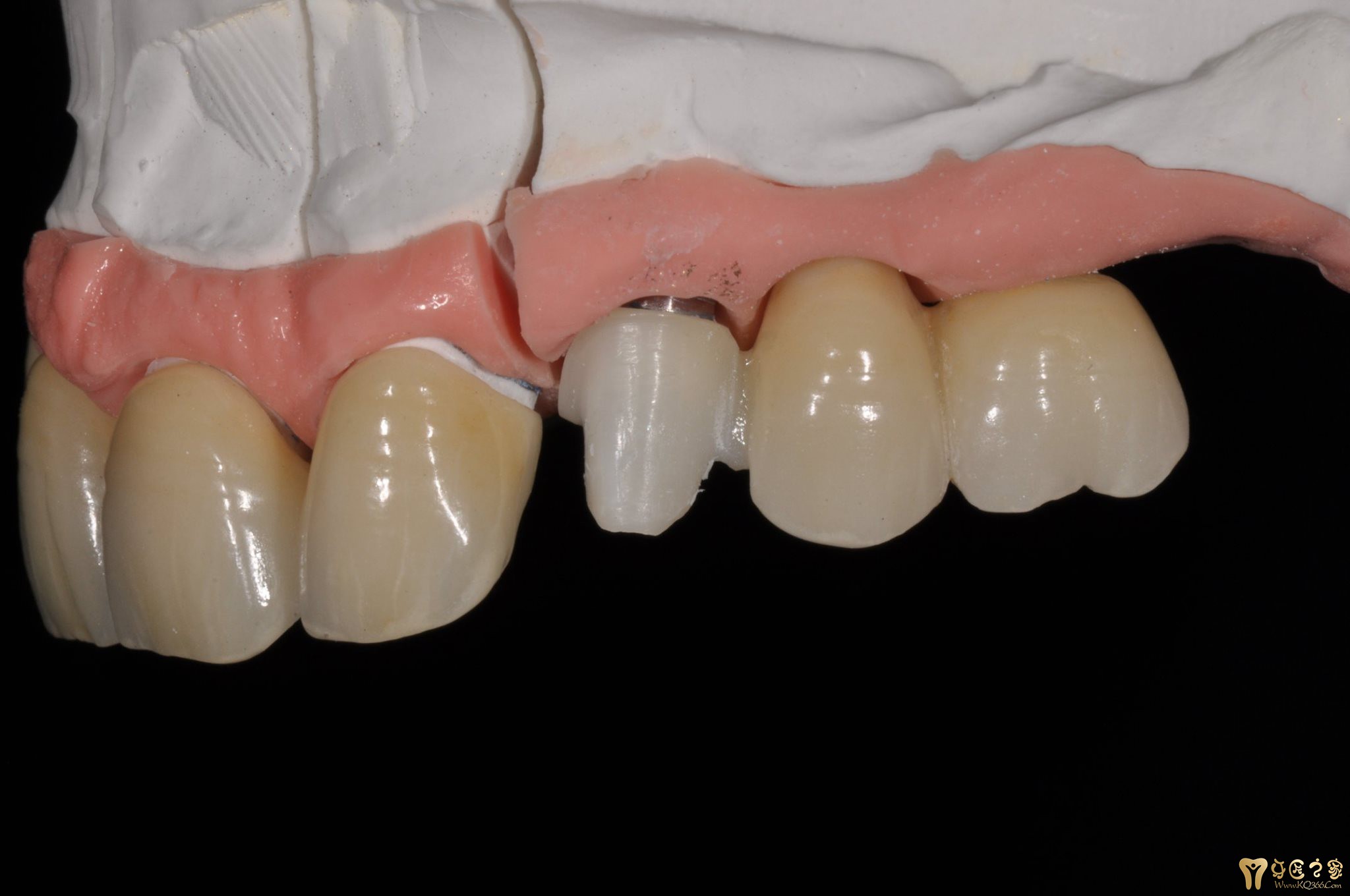 美学仿生案例-精华推荐-牙匠之家 - 中国牙匠之家