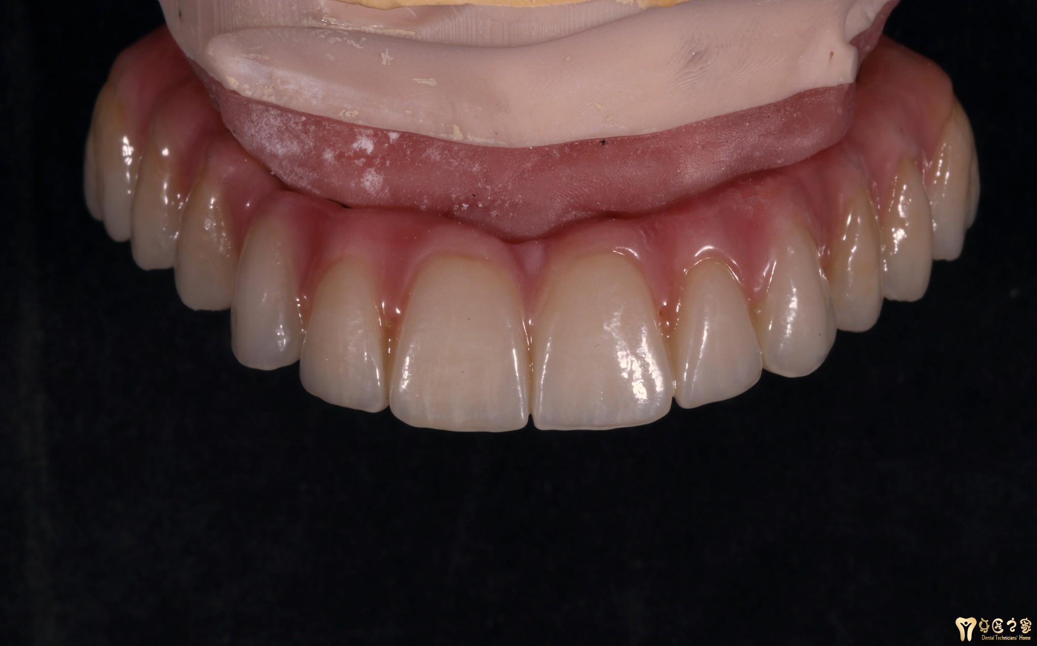 bayramov罗凤霞牙龈聚合瓷处理alexandr korchagin罗凤霞上瓷sargis a